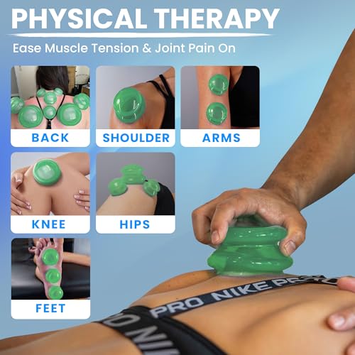 Blue Silicone Cupping Set, 4 Piece Q157784